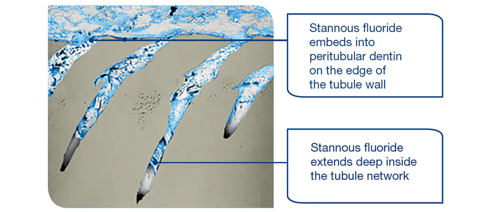 Stannous Fluoride Science Sensodyne Rapid Relief